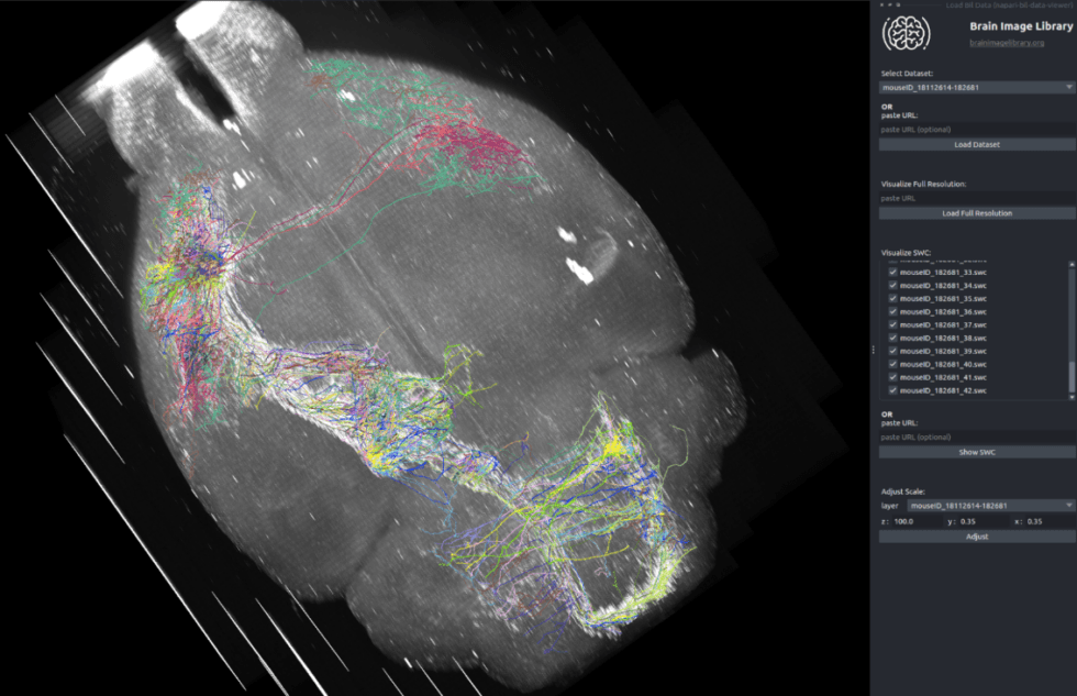 First Formal Paper Describes Progress of Brain Image Library | PSC